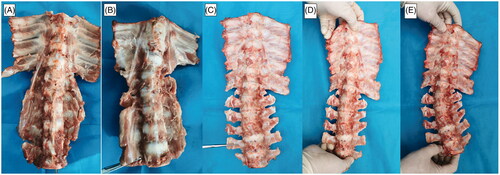 Figure 8. Asymmetric segmental spine growth and structural scoliosis after the operation. (A–C) Spine in the neutral position with progressive scoliosis within 6 weeks. (D,E) Flexion and extension positions showing a structural scoliosis curve at 6 weeks after the operation.