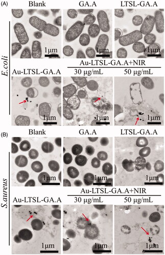 Figure 8. Morphological changes of drug-resistant E. coil (A) and S. aureus (B) through TEM observation. Cells treated with GA.A (50 μg/mL), LTSL-GA.A (50 μg/mL), Au-LTSL-GA.A (50 μg/mL) were set as control groups. Cells were treated with different concentration of Au-LTSL-GA.A (30 and 50 μg/mL) for 2 h in incubation and measured for 5 min upon irradiation (0.25 W/cm2). Bacteria without NPs were as blank. The red arrows point to the NPs.