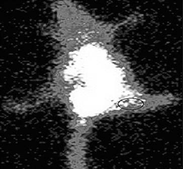 Figure 5. Whole body scintigraphic images of radio-labelled 99mTc-SLENU nitrosourea in female BALB/c mice bearing s.c. EAT (in the right thigh) tumour implant.