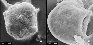 Figure 5 Scanning electron micrograph of macrophage (P388-D1 cells) exposed to BChl-a solution. (A) control (without irradiation) shows intact cell; (B) BChl-a (50 μM) after a 30 J/cm2 irradiation dose shows photodamage with cell morphology alteration. Scale barr 1 μ m.