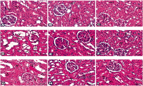 Figure 5. Photomicrographs of kidney sections demonstrated the outcome of ‘4h’ drug in all examined groups: (A) Histologic kidney section G1 showed normal glomerulus (G), proximal convoluted tubules (PCT), and distal convoluted tubules (DCT). Kidney sections from G2 (B) and G3 (C) revealed photographs similar to G1. (D) Histological kidney section from infected group G6 displayed cytoplasmic and nuclear changes in the glomerulus (G) and renal tubules constituents (CO); karyorrhexis (KR), karyolysis (KY), cytoplasmic vacuolation (V), aggregated inflammatory cells (IN), and congested blood vessels (CN). (E) Sections from G7 posed limited cells with pyknosis (P) and karyolysis (KY), besides some inflammatory cells (IN). (F) Sections from G8 were marked with few inflammatory cells (IN) and renal tubule cells with karyorrhexis (KR). (G) Histological kidney section from salmonella infected group (G9) exhibited disruption in renal tubule constituents (CO) with pyknosis (P), karyorrhexis (KR), karyolysis (KY), infiltration of inflammatory cells (IN), and congested blood vessels (CN). (H) Sections from G10 developed few disturbances in renal tubule constituents (CO); karyolysis (KY) as well a few inflammatory cells (IN). (I) Sections from G11 highlighted scarce areas of karyolysis (KY) and inflammatory cells (IN). (H&E staining, 400x Magnification, Scale bar = 50 μm).
