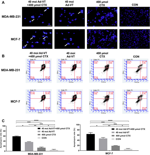 Figure 3 Detection of apoptosis in BC cells induced by the combination of Ad-VT and cyclophosphamide. (A) Hoechst results show that the nuclei of MCF-7 and MDA-MB-231 cells treated with 40 MOI Ad-VT, 400 µM cyclophosphamide, and their combination exhibited different degrees of nuclear fragmentation and nuclear overstaining. (B and C) Annexin V-FITC/PI staining was used to analyze the apoptosis levels of MCF-7 and MDA-MB-231 cells. The apoptosis levels were observed 48 h after treatment of the cells with 40 MOI Ad-VT, 400 nM cyclophosphamide, and their combination. The scale bar equals 50 μm. Data are representative of three independent experiments (n = 3). *P < 0.05, **P < 0.01, ***P < 0.001, ****P < 0.0001.