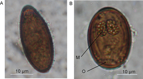 Figure 5  Trematode eggs. A, Tui. B, North Island Saddleback/Mokoia Island. Abbreviations: M, Miracidium larvae; O, operculum.