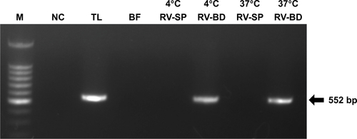 Figure S3 Comparison of rotavirus adsorption on anti-rotavirus antibody-integrated magnetic beads performed at 4°C and 37°C.Notes: Rotavirus-infected cell lysate (10 µL) was diluted with PBS (500 µL) and then incubated for 5 minutes with anti-rotavirus antibody-integrated magnetic beads at either 4°C or 37°C. After incubation, the following fractions were obtained: 1) diluted rotavirus sample before incubation with the beads (BF), 2) supernatant fraction after incubation with the anti-rotavirus antibody-integrated MNBs at 4°C (4°C RV-SP), 3) bead fraction after incubation with anti-rotavirus antibody-integrated MNBs at 4°C (4°C RV-BD), 4) supernatant fraction after incubation with the anti-rotavirus antibody-integrated MNBs at 37°C (37°C RV-SP), 5) bead fraction after incubation with anti-rotavirus antibody-integrated MNBs at 37°C (37°C RV-BD), and 6) total sample containing the same quantity of rotavirus as in 10 µL of rotavirus-infected cell lysate (total fraction, TL). Viral genomic RNA was subsequently extracted from the above fractions using a QIAamp Viral RNA mini kit and subjected to a RT-reaction. The diluted cDNA was amplified in a reaction mixture containing Ex Taq (Takara Bio Inc.) and Ex Taq buffer as well as primers recognizing rotavirus VP7 by 30 cycles of temperature cycling at 94°C for 1 minute, 60°C for 1 minute, and 72°C for 1 minute. Rotavirus VP7 gene (552 bp) in the cDNA was amplified by PCR, as described in Materials and methods. PCR products were analyzed by agarose gel electrophoresis (1.2% gel). The identity of the amplified products was subsequently confirmed by DNA sequencing. The left-hand lane is size marker (M), which includes DNA of 100, 200, 300, 400, 500, 600, 700, 800, 900, 1,000, 1,200, and 1,500 bp. The position of the 552 bp band for VP7 is indicated by an arrow. As a NC, a water sample (ie, no rotavirus) was also subjected to RT-PCR.Abbreviations: MNBs, magnetic nanobeads; NC, negative control; RT, reverse transcription.