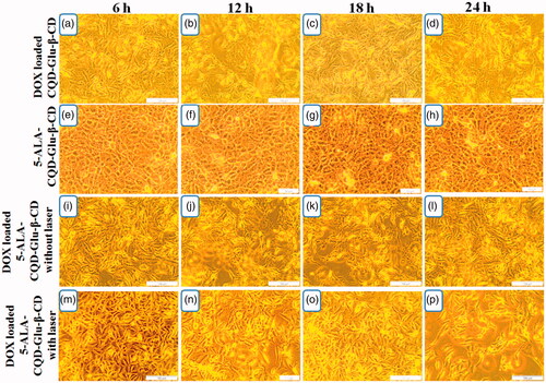 Figure 9. In vitro morphological changes by the chemo-photodynamic effect of breast cancer (MCF-7) cell treated with DOX/CQD-Glu-β-CD, 5-ALA-CQD-Glu-β-CD, and DOX/5-ALA-CQD-Glu-β-CD nanocarrier with and without irradiation in various time-dependent manners such as 6 h, 12 h, 18 h, and 24 h and IC50 concentration of 60 μg/mL at scale bar: ∼100 μm.