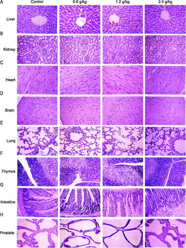 Figure 5. Histopathological organ examination after administration of 2036S-QXR using haematoxylin and eosin staining (10×). (A) Representative images of liver sections. (B) Representative images of kidney sections. (C) Representative images of heart sections. (D) Representative images of brain sections. (E) Representative images of lung sections. (F) Representative images of thymus sections. (G) Representative images of intestinal sections. (H) Representative images of prostate sections.