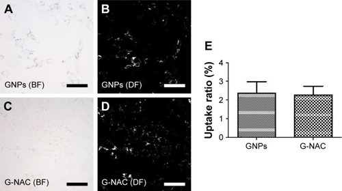 Figure 5 BF and DF images of hASCs treated with 20 µM GNPs (A, B) and G-NAC (C, D) for 1 day. The DF images evaluated by ImageJ program (bright pixel/total pixel), and the results are mean ± SD of triplicate experiments (E). Scale bars are 100 µm.Abbreviations: BF, bright field; DF, dark field; G-NAC, gold nanoparticles-N-acetyl cysteine; GNPs, gold nanoparticles; hASCs, human-derived stem cells.