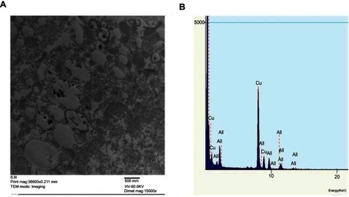 Figure 2 Ultrastructural localization of AuNPs in lung cells at one day post-injection of AuNPs: (A) TEM micrograph showing the cellular uptake of AuNPs by lung cells that were localized predominantly as electron dense clusters enclosed within the endosomes. Magnification: 36600X. Scale bar: 500 nm (B) EDX elemental analysis confirmed the presence of Au as depicted by two sharp peaks at 2.121 keV (AuL) and 9.712 keV (AuM).