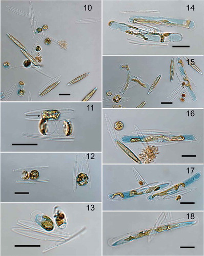 Figs 10–18. Sexual reproduction in Haslea provincialis. Fig. 10. Gametogenesis in the mixture of sexually compatible clones NCC 341 and NCC 342. Gametes released to the medium have low chance to fuse. Fig. 11. Gametes in the pair of gametangia shortly before fusion (arrow), note that the other pair of gametes probably started development earlier and has swelled (below). Fig. 12. Normally two pairs of gametes produced fuse to give rise to two zygotes (left); but sometimes, when more gametes fuse, a huge zygote results (right). Fig. 13. Two young auxospores. Fig. 14. Middle stage of auxospore growth with the development of the perizonium. Fig. 15. Unique triradiate and normal tubular (bi-radiate) auxospores. Fig. 16. Sometimes, in a pair of gametangia only one zygote passes to the stage of auxospore while the other one fails to develop. Fig. 17. Normally developing pair of auxospores. Fig. 18. Initial cell formed inside the auxospore. Scale bars: 20 μm (Figs 10–18).