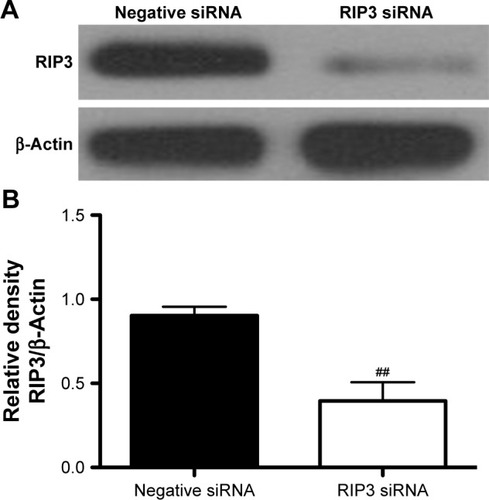 Figure 4 The levels of RIP3 protein expression were determined by Western blotting after siRNA transfection in HT22 cells.