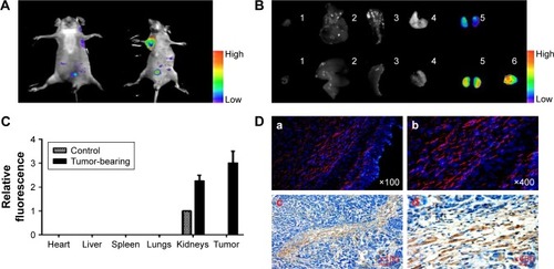 Figure 6 Detection of FAPα enzyme in vivo. Marker-MNPs (100 μL in PBS, 100 nM by peptide) were injected into Eca109 tumor-bearing mice (treated group) or healthy mice (control group) via tail vein.Notes: (A) In vivo fluorescence images of healthy mice and Eca109 tumor-bearing mice injected i.v. with marker-MNPs. Images were acquired at 1 hour after injection and were normalized by the maximum average value. The color bar indicates radiant efficiency (low, 0; high, 0.15×105). (B) Representative images of dissected organs and tissues of healthy mice (upper row) and Eca109 tumor-bearing mice (lower row) sacrificed at 6 hours after injected i.v. with marker-MNPs. The color bar indicates radiant efficiency (low, 0; high, 0.13×105). (C) Relative quantification of the fluorescent signal of organs after the mice were infused with mixtures of marker-MNPs (Student’s t-test; n=8 mice, SD). (D) Immunofluorescence images of tumor sections injected with marker-MNPs (red; a, b). Tumor sections were counterstained with DAPI (blue; c, d). Analysis of expression of FAPα in Eca109 tumor section by immunohistochemistry.Abbreviations: DAPI, 4′,6-diamidino-2-phenylindole; FAPα, fibroblast activation protein α; i.v., intravenously; MNPs, magnetic iron oxide nanoparticles.