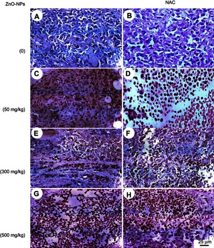 Figure 10 Photomicrographs representing immunohistochemistry staining of P53 expression in ESC muscle sections and showing (A) negative staining of P53 in ESC of untreated ESC group. (B) negative staining of P53 in ESC+NAC group. (C and D) ZnO-NPs (50 mg/kg) alone or combined with NAC, respectively, with moderate P53 expression. (E and F) ZnO-NPs (300 mg/kg) alone or combined with NAC, respectively, with an increase in P53 expression while groups (G and H) ZnO-NPs (500 mg/kg) alone or combined with NAC, respectively, with the highest level of P53 expression; 400× magnification.