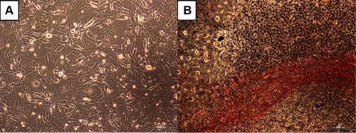 Figure 1 The morphological changes of 3T3-L1 cells. (A) 3T3-L1 pre-adipocytes. (B) 3T3-L1 fibroblasts-derived adipocytes as validated by the Oil Red-O staining. Magnification: 40X, scale bars: 200 µm.