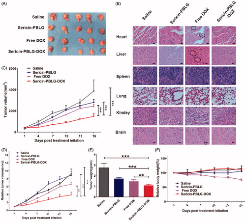 Figure 6. In vivo anti-tumor effect of sericin-PBLG-DOX. (A) Images of tumors derived from mice treated with drugs. (B) H&E images of the major organs. Scale bar, 50 nm. The regions circled with the black lines indicate the location of the potential lesion. (C) Volume of MCF-7 ADR tumors isolated from mice. (D) Relative volume of MCF-7 ADR tumors isolated from mice. (E) Weight of MCF-7 ADR tumors isolated from mice. (F) Relative body weight of MCF-7 ADR tumor-bearing mice. Data are shown as the mean ± SD, n = 5, **p < .01, ***p < .001, N.S. indicates p > .05.