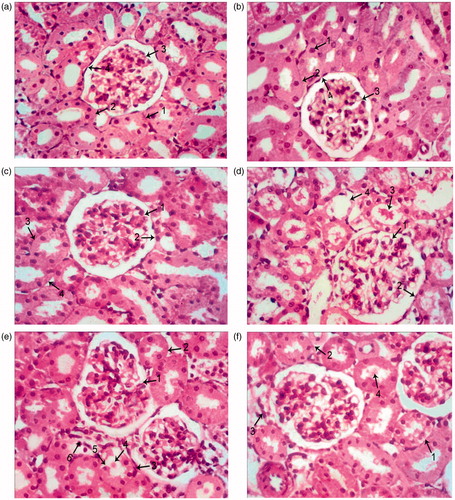 Figure 2. Photomicrographs of kidney sections stained by H & E. (a): A section taken from kidney of control group, (b): a section taken from kidney of sodium selenite treated group shows 1-PCT, 2-DCT, 3-glomerular capillary tuft, 4-parietal layer of Bowman’s capsule, (c): a section taken from kidney of taurine treated group shows 1-glomerular capillary tuft, 2-parietal layer of Bowman’s capsule, 3-PCT, 4-DCT, (d): a section taken from kidney of HgCl2 group shows 1-glomerular capillary tuft, 2-parietal layer of Bowman’s capsule, 3-intraluminal acidophilic mass, 4-denuded tubule with detached cell, (e): a section taken from kidney of sodium selenite pretreated group shows 1-glomerluar capillary tuft, 2-PCT, 3-PCT lined by normal and degenerated cell (5), 4-interaluminal small mass, 6-cellular infiltration and (f): a section taken from kidney of taurine pretreated group shows: 1-rernal tubule contained between its lining cells some vacuolated cells, 2-normal PCT, 3-cellualar infiltration, 4-small luminal acidophilic mass (H&E X200).