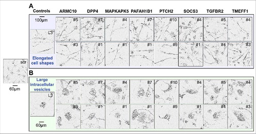 Figure 2. Toxic shRNAs derived from eight TS genes induce DISE-like morphological changes in HeyA8 cells.Representative phase-contrast images showing elongated cell shapes (A); enlarged, flattened cells and presence of intracellular granules in HeyA8 cells infected with shRNAs against eight of the 17 TS and shL3 (B). shScr treated cells are shown as control.