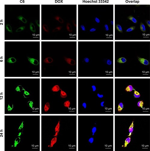 Figure 5 The intracellular migration fluorescence images of CS-ALG-DOX@TPGS-PLGA-C6 NPs.Notes: Red fluorescence indicates inner smaller CS-ALG NPs labeled with free DOX, green fluorescence indicates outer larger TPGS-PLGA-C6 NPs, and blue fluorescence indicates the region of the nucleus stained with Hoechst 33342. Yellow fluorescence (red overlapping green) represents the co-localization of CS-ALG NPs and TPGS-PLGA NPs, and purple fluorescence (red overlapping blue) represents the co-localization of CS-ALG NPs and the nucleus. Scale bar, 10 μm.Abbreviations: DOX, doxorubicin; C6, coumarin-6; CS-ALG NPs, chitosan-alginate nanoparticles carrying doxorubicin; TPGS-PLGA-C6 NPs, vitamin Ed-a-tocopheryl polyethylene glycol 1000 succinate-modified poly(lactic-co-glycolic acid) nanoparticles carrying C6; CS-ALG-DOX@TPGS-PLGA-C6 NPs, CS-ALG NPs located at TPGS-PLGA-C6 NPs.