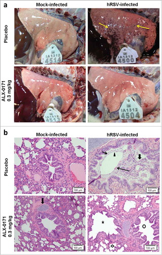 Figure 6. Lung pathology in mock-infected or hRSV-infected lambs treated with either placebo or ALX-0171 from study 3. (a) Images of lungs from mock-infected lambs (left column) and hRSV-infected lambs (right column). Lambs were either treated with placebo (top row) or ALX-0171 (bottom row) for 3 days consecutively. Images were taken at necropsy on day 6 post-infection. Lungs from lambs 27 (tag ID 4514), 38 (tag ID 4500), 33 (tag ID 4513) and 44 (tag ID 4504) are shown. Viral lesions are indicated with yellow arrows and are visible as plum-red lesions in lamb 38. (b) Microscopic (histopathologic) lung lesions of hRSV infected lambs. Microscopic lung images are from the same lamb lungs shown in Figure 6a. There was no microscopic lung lesions seen in the mock-infected placebo and ALX-0171-treated groups. The mock-infected placebo-treated group picture contains a normal bronchiole lacking lesions, while the mock-infected ALX-0171-treated group has a bronchus with surrounding cartilage (fat arrow) and also lacks lesions. The hRSV-infected placebo-treated group had a wide spectrum of lung lesions, with bronchitis characterized by the lumen which contains neutrophils (thin short arrow), sloughed epithelial cells (fat arrow), mucin (arrowhead), and red blood cells (long thin arrow). The hRSV-infected ALX-0171-treated group had significantly reduced histopathological lesions when compared to the mock-infected placebo and ALX-0171-treated groups, which was evident by the clear bronchi (circle), bronchioles (star) and alveolar spaces (diamond) present in the picture.