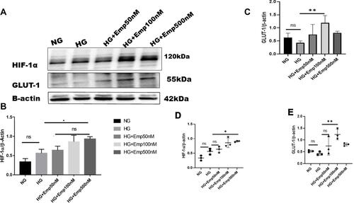 Figure 1 Effect of empagliflozin on expression of HIF-1α pathway in HK-2 cell line. HK-2 cells were planted in 5.5mM glucose and 25mM glucose medium with or without empagliflozin treatment under normoxia condition for 72 h. (A) Western blotting was performed using anti-HIF-1α, anti-GLUT-1 and anti-β-actin antibodies. β-actin was used as a loading control. (B, C) Quantification of the Western blot data. (D–E) Dot plots scatter represented individual measurement. The data represent the mean ± SD of three independent experiments. *P < 0.05, **P < 0.01 vs. high glucose.Abbreviation: ns, non-significant.