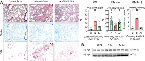 Figure 4 Ac-SDKP inhibits MMP-12 and stabilizes elastin in silicotic rats. (A) Elastin staining, Bar=200 μm, Data are presented as the mean ± SD. n = 8 per group; (B) Protein expression of MMP-12 in rats lungs measured by Western blotting. Data are presented as the mean ± SD. n = 3 per group.