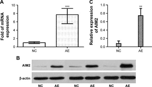Figure 1 Expression of AIM2 mRNA and protein measured by RT-PCR and Western blotting.