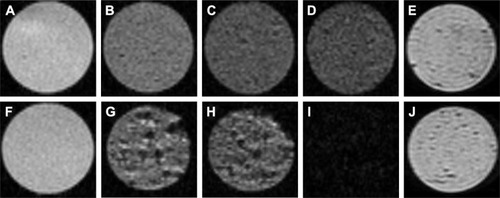 Figure 3 MR images of gel phantoms.Notes: Gel phantoms without cells (A) and with unlabeled cells (F). Gel phantoms with iPSC-NPs labeled with different concentrations of CZF in culture medium for 72 hours: 5 μg Fe/mL (B); 10 μg Fe/mL (C); 15 μg Fe/mL (D) and 1 week after onset of differentiation (E). Gel phantoms with iPSC-NPs labeled with PLL-coated γ-Fe2O3 at concentrations of 5 μg Fe/mL (G); 10 μg Fe/mL (H); 15 μg Fe/mL (I); and 1 week after onset of differentiation (J). Signal decrease and hypointense spots in phantoms correspond to the amount of metallic ions in cells.Abbreviations: MR, magnetic resonance; iPSC-NPs, induced pluripotent stem cells-derived neural precursors; CZF, silica-coated cobalt zinc ferrite nanoparticles; PLL-coated γ-Fe2O3, poly-l-lysine-coated iron oxide superparamagnetic nanoparticles.