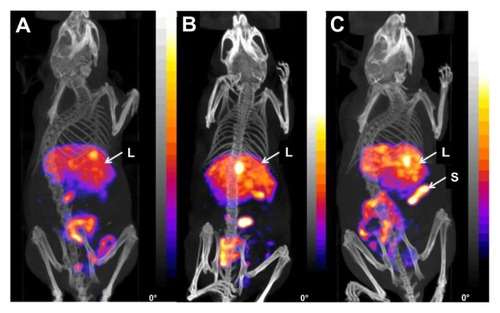 Figure 6 Fused micro single photon emission computed tomography/computed tomography images of three beige severe combined immunodeficiency mice with U-87 MG tumor xenografts on the left flank (4 hours postinjection) showing (A) 111In-labeled lowRLP, (B) 111In-labeled medRLP, and (C) 111In-labeled highRLP.Notes: All 111In-labeled RLPs showed main uptake in the liver, spleen, and intestine. For 111In-highRLP, uptake in the spleen was higher compared to the other two RLPs. Animals were placed in the anterior prone position (20 projections, 30 minutes).Abbreviations:111In, indium-111; L, liver; lowRLP, RLP with low RGD loading; highRLP, RLP with high RGD loading; medRLP, RLP with medium RGD loading; RGD, arginyl–glycyl–aspartic acid; RLP, liposomal nanoparticles carrying an RGD building block; S, spleen.