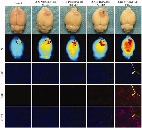 Figure 5. Representative ex vivo NIR fluorescence images of dissected brains from rats bearing C6 gliomas sacrificed at 2 h and qualitative evaluation of QD fluorescence in the glioma zone in rat brains after administration of QD formulations. Black circle: glioma zone; red: QDs; blue: cell nuclei; yellow line: glioma border; yellow arrow: direction of glioma growth. Original magnification: ×200.
