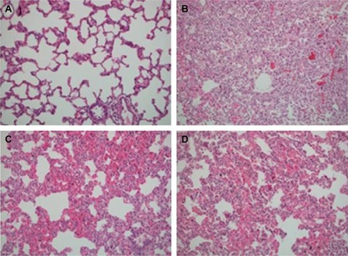 Figure 3 Skeletal muscle biopsies of four groups.