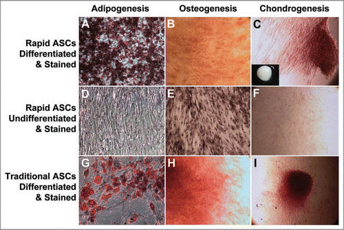 Figure 2 Characterization of ASC differentiation. The differentiation potential of ASCs isolated in the streamlined, rapid protocol were compared to ASCs isolated using the standard protocol (traditional ASCs). Cells were induced to differentiate into adipocytes ((A) for rapid ASCs and (G) for traditional ASCs; (D) rapid ASCs grown for 2 weeks without adipogenic media as control; all stained with oil red O and hematoxlin), osteocytes ((B) for rapid ASCs and (H) for traditional ASCs; (E) rapid ASCs grown 2 weeks without osteocyte induction media as control; all stained with Alizarin red S and hematoxylin), and chondrocytes [(C) for rapid ASCs and (I) for traditional ASCs, both in a micromass (solid micromass pellet, insert, (C)]; (F) unpelleted rapid ASCs grown 4 weeks in induction media as control; all samples stained for Safranin O).