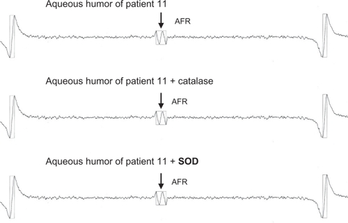 Figure 2 In 13 of the 17 eyes in the non-NVG group, AFR spectra are observed and the waveforms do not change following addition of catalase or SOD.