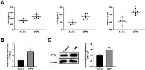 Figure 2. Detection of inflammatory factors in serum and RTEL1 expression in lung tissues of COPD mice. (A) ELISA was applied to detect TNF-α, IL-1β and MMP-9 in mice. (B) RT-qPCR was used to detect the mRNA level of RTEL1. (C) Western blotting was performed to detect the protein expression of RTEL1. **p < .01 vs. control.