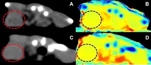 Figure 7 (A) and (C) are conventional CT images before and after intravenous injection respectively. (B) and (D) are effective atomic number images before and after intravenous injection respectively. The red and black circles represent the tumor tissues.