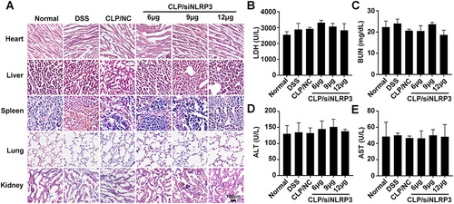 Figure 7 CLP/siNLRP3 had no significant side effects in vivo. (A) HE staining of frozen sections of major organs (heart, liver, spleen, lung, and kidney) in mice with DSS-induced UC. (B–E) The levels of LDH (B), BUN (C), ALT (D), and AST (E) were detected with blood biochemistry to assess cardiac (LDH), kidney (BUN) and liver (ALT and AST) function, respectively. N=6 per group, data were mean± SEM.
