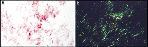 Figure 1 Isolated amyloid fibrils composed of Aα chain fragment of fibrinogen (a) stained with Congo red and visualized by light microscopy and (b) between crossed polars, showing characteristic apple-green birefringence. Figure adapted from reference Citation83.