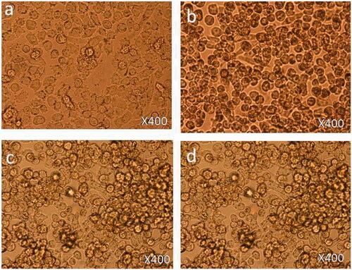 Figure 3. Cell morphology: the HCT-116 cells were non-treated (a) and treated with FMSP-nanoparticles (12.5 μg/mL) for 6 h (b), 24 h (c) and 48 h (d). 400× magnification.