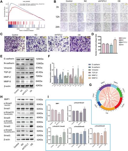 Figure 7 Effect of FSTL3 on invasion and migration and its relationship with epithelial–mesenchymal transition (EMT)-related proteins and BMP/SMAD signals. (A) Gene Set Enrichment Analysis (GSEA) of FSTL3. (B–D) Effect of FSTL3 knock‐down and overexpression on the migratory and invasive abilities of gastric cancer cells assessed using transwell migration and scratch-wound cell migration assays (**P < 0.01). (E and F) The levels of EMT-related proteins were analyzed using Western blotting 24 hours after transfection (**P < 0.01). (G) Correlation coefficient circles for FSTL3 and EMT-related genes from the TIMER database. Red represents positive correlations and green represents negative correlations; stronger correlations are indicated in darker colors. (H and I) FSTL3 modulates BMP/SMAD signals (*P < 0.05, **P < 0.01).