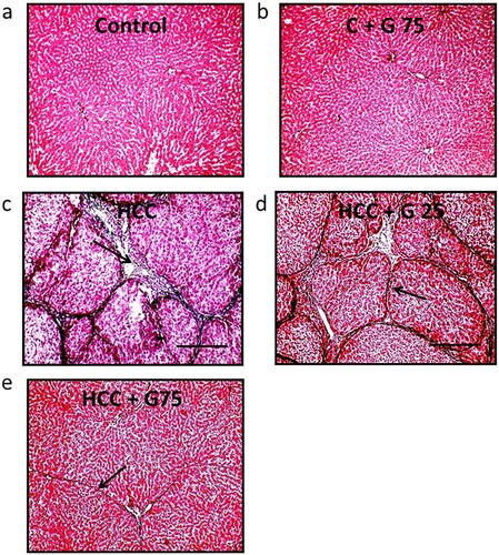 Figure 5. Hepatic sections stained with Masson’s trichrome stain. (a) No fibrosis was demonstrated in the control group or the (b) control group treated with 75 mg/kg genistein. (c) HCC displayed green stained broad fibrous septa (arrows). (d) HCC treated with 25 mg/kg genistein demonstrated a mild decrease in fibrous tissue deposition (arrow). (e) HCC treated with 75 mg/kg genistein displayed very mild fibrous tissue deposition (arrow). Scale bars, 100 µm. HCC, hepatocellular carcinoma.