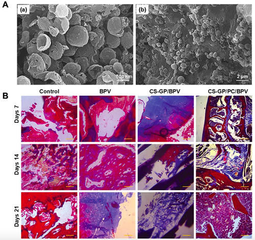 Figure 2 Representative study shows the potential of polymeric nanoparticle-based drug delivery systems for local anesthetics. (A) SEM micrographs of PCL nanocapsules (a) and CS-GP/PCL polymeric hydrogel (b). a. scale bar, 500 nm; b. scale bar, 2 μm. (B) Histopathological evaluation of the anti-inflammatory effects of bupivacaine-loaded CS-GP hydrogel and CS-GP/PCL polymeric hydrogel on 7, 14, and 21 days were stained with Masson’s trichrome stain. Cytoplasm and muscle fibers stain red, nuclei stains black, and collagen displays blue coloration. There was no obvious tissue damage in any of the test groups. Scale bar, 100 μm. Reproduced from Deng W, Yan Y, Zhuang P, et al. Synthesis of nanocapsules blended polymeric hydrogel loaded with bupivacaine drug delivery system for local anesthetics and pain management. Drug Deliv. 2022;29(1):399–412. Creative Commons.Citation18