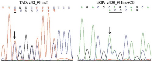 Figure 3. Gene mutation of CEBPA in TAD and bZIP domain detected by Sanger sequencing showed a c.92_93 insT and c.930_931insACG mutation.