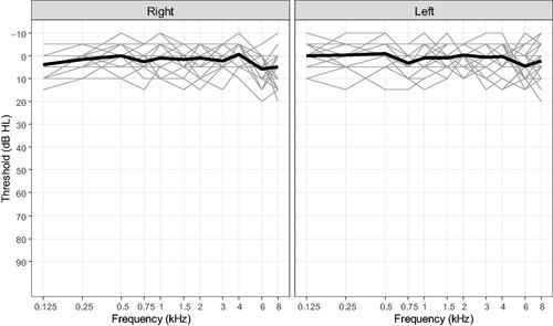 Figure 3. Pure-tone audiograms for 50 (25 left and 25 right) ears measured with a RadioEar DD45 headset. Thick line illustrates the mean.