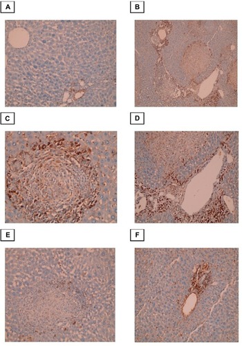 Figure 5 Photomicrographs of the liver stained with Masson trichrome.Notes: (A) Control group, showing normal (typical) distribution of connective tissue (×100). (B) Infected untreated group, showing granulomatous lesions with condensed fibrous connective tissue in the granuloma and portal tracts (×200). (C)Portal-portal bridging fibrosis (×100). (D)-Portal tract that showing marked dilatation of portal vein and excess fibrosis (×200). (E) PZQ treated group. (F) Eugenol treated group, showing reduced size and number of granuloma with less fibrous tissue in the granuloma and portal tracts (×100).