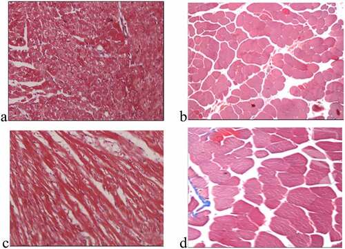 Figure 2. Fibrosis characteristics of the myocardial tissues (×160)