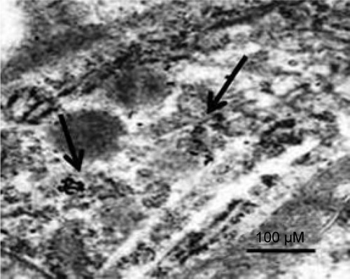 Figure 3 TEM image of the uptake of gold nanoparticles in the livers of rats.Note: Black arrows indicate where there is accumulation of gold nanoparticles.Abbreviation: TEM, transmission electron microscope.