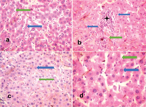 Figure 1. H and E-stained liver sections of rats.