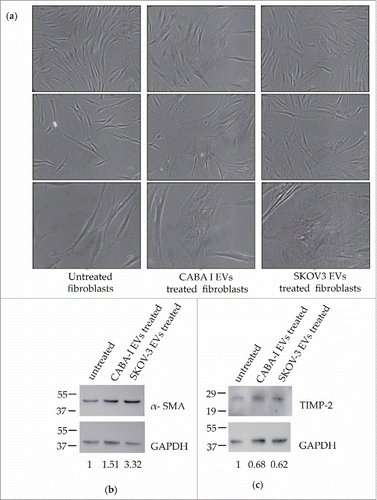 Figure 2. Morphological and markers' expression changes of treated fibroblasts. (a) Representative images of cell morphology: first column from the left shows untreated fibroblasts (NHDF), the second and third ones display NHDFCI and NHDFSK, respectively. The 5X objective of an optical inverted microscope was used to capture images of the first two rows, while pictures of the third row were captured with the 10X objective. The scale bar, which is barely visible, has a size of 1000 nm in all the images. (b-c) Western Blot analysis of α-SMA (b) and TIMP-2 (c); molecular weights (kDa) are reported on the left of each image. Densitometric analysis of the signals were perfomed with the program Image J and using GAPDH for the normalization. The values of the ratios are shown at the bottom of each panel and the ratio value was conventionally attributed as 1 in untreated fibroblasts.