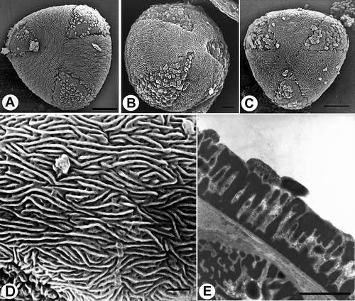 Figure 7. Pollen grains of Veronica subgenus Chamaedrys (A & E. Subsect. Microspermae; B–D. Subsect. Microspermoides). A & E. V. arvensis: A. polar view (SEM); E. section through pollen wall (TEM). B & D. V. dillenii: B. polar view (SEM); D. striato-reticulate surface structure, apocolpium (SEM). C. V. verna, polar view (SEM). Scale bars – 5 μm (A, C); 2 μm (B); 1 μm (D, E).
