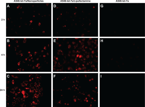 Figure S1 Cellular uptake of fluorescently labeled A546-let-7a encapsulated with dextran nanoparticles. U-2OS cells were transfected with 100 nM A546-let-7a (red) encapsulated with (A–C) dextran nanoparticles, (D–F) 100 nM A546-let-7a mixed with Life Technologies Lipofectamine® RNAiMAX (Thermo Fisher Scientific, Waltham, MA, USA), or (G–I) 100 nM A546-let-7a alone. The cells were washed with phosphate-buffered saline and visualized by fluorescence microscopy at 2, 4, and 24 hours after transfection.