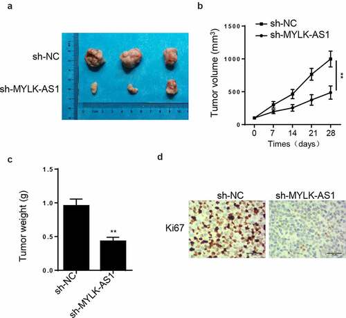 Figure 3. Effect of MYLK-AS1 on GC tumor growth in vivo. (A) The tumors after being removed from the mice. (B) Tumor volume was calculated. (C) Tumor weight was determined after tumors were harvested. (D) IHC staining was conducted to determine Ki67 expression of tumors from sh-MYLK-AS1 and sh-NC groups. **p< 0.01