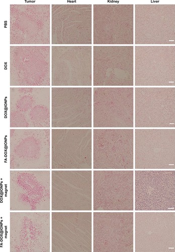 Figure 8 Prussian blue micrographs (×200) of tumor sections, heart, kidney, and liver from PBS, free DOX, DOX@IONPs, FA-DOX@IONPs, DOX@IONPs plus magnetic treatment, and FA-DOX@IONPs plus magnetic treatment groups on day 24. Scale bars =50 μm.Abbreviations: DOX, doxorubicin; FA, folic acid; IONP, iron oxide nanoparticle.